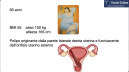 Polipectoomia endometriale 5fr